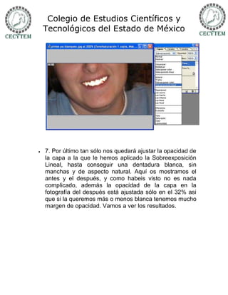 Colegio de Estudios Científicos y
    Tecnológicos del Estado de México




   7. Por último tan sólo nos quedará ajustar la opacidad de
    la capa a la que le hemos aplicado la Sobreexposición
    Lineal, hasta conseguir una dentadura blanca, sin
    manchas y de aspecto natural. Aquí os mostramos el
    antes y el después, y como habeis visto no es nada
    complicado, además la opacidad de la capa en la
    fotografía del después está ajustada sólo en el 32% asi
    que si la queremos más o menos blanca tenemos mucho
    margen de opacidad. Vamos a ver los resultados.
 