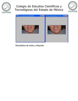 Colegio de Estudios Científicos y
Tecnológicos del Estado de México




Resultados de antes y después
 
