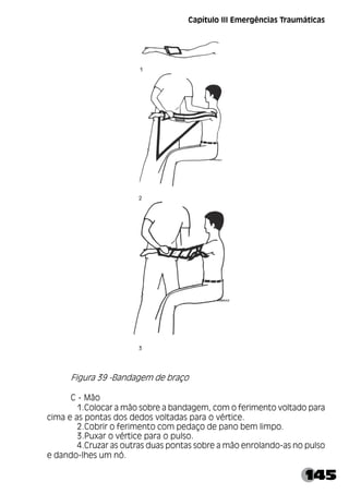 145
Capítulo III Emergências Traumáticas
Figura 39 -Bandagem de braço
C - Mão
1.Colocar a mão sobre a bandagem, com o ferimento voltado para
cima e as pontas dos dedos voltadas para o vértice.
2.Cobrir o ferimento com pedaço de pano bem limpo.
3.Puxar o vértice para o pulso.
4.Cruzar as outras duas pontas sobre a mão enrolando-as no pulso
e dando-lhes um nó.
 