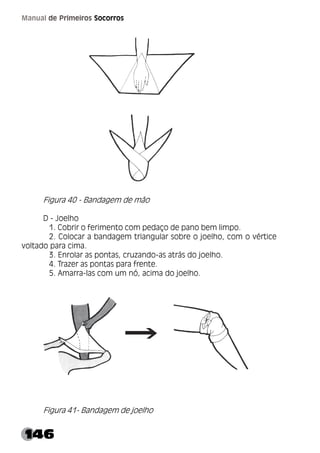 146
Manual de Primeiros Socorros
Figura 40 - Bandagem de mão
D - Joelho
1. Cobrir o ferimento com pedaço de pano bem limpo.
2. Colocar a bandagem triangular sobre o joelho, com o vértice
voltado para cima.
3. Enrolar as pontas, cruzando-as atrás do joelho.
4. Trazer as pontas para frente.
5. Amarra-las com um nó, acima do joelho.
Figura 41- Bandagem de joelho
 