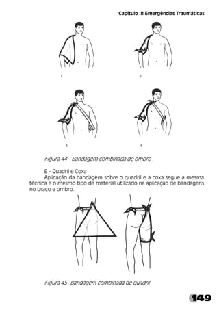 149
Capítulo III Emergências Traumáticas
Figura 44 - Bandagem combinada de ombro
B - Quadril e Coxa
Aplicação da bandagem sobre o quadril e a coxa segue a mesma
técnica e o mesmo tipo de material utilizado na aplicação de bandagens
no braço e ombro.
Figura 45- Bandagem combinada de quadril
 