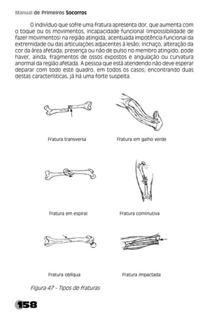 158
Manual de Primeiros Socorros
O indivíduo que sofre uma fratura apresenta dor, que aumenta com
o toque ou os movimentos, incapacidade funcional (impossibilidade de
fazer movimentos) na região atingida, acentuada impotência funcional da
extremidade ou das articulações adjacentes à lesão; inchaço, alteração da
cor da área afetada; presença ou não de pulso no membro atingido, pode
haver, ainda, fragmentos de ossos expostos e angulação ou curvatura
anormal da região afetada. A pessoa que está atendendo não deve esperar
deparar com todo este quadro, em todos os casos; encontrando duas
destas características, já há uma forte suspeita.
Figura 47 - Tipos de fraturas
 
