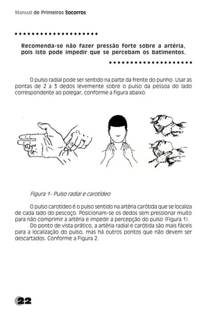 22
Manual de Primeiros Socorros
Recomenda-se não fazer pressão forte sobre a artéria,
pois isto pode impedir que se percebam os batimentos.
O pulso radial pode ser sentido na parte da frente do punho. Usar as
pontas de 2 a 3 dedos levemente sobre o pulso da pessoa do lado
correspondente ao polegar, conforme a figura abaixo.
Figura 1- Pulso radial e carotídeo
O pulso carotídeo é o pulso sentido na artéria carótida que se localiza
de cada lado do pescoço. Posicionam-se os dedos sem pressionar muito
para não comprimir a artéria e impedir a percepção do pulso (Figura 1).
Do ponto de vista prático, a artéria radial e carótida são mais fáceis
para a localização do pulso, mas há outros pontos que não devem ser
descartados. Conforme a Figura 2.
○ ○ ○ ○ ○ ○ ○ ○ ○ ○ ○ ○ ○ ○ ○ ○ ○ ○ ○ ○
○ ○ ○ ○ ○ ○ ○ ○ ○ ○ ○ ○ ○ ○ ○ ○ ○ ○ ○ ○
 