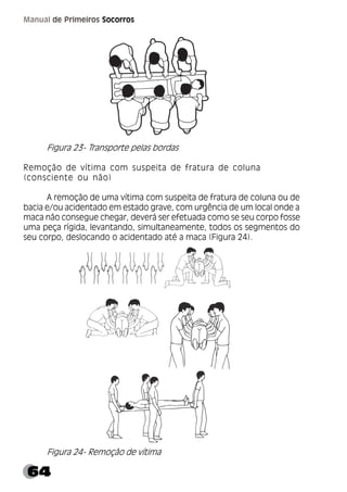 64
Manual de Primeiros Socorros
Figura 23- Transporte pelas bordas
Remoção de vítima com suspeita de fratura de coluna
(consciente ou não)
A remoção de uma vítima com suspeita de fratura de coluna ou de
bacia e/ou acidentado em estado grave, com urgência de um local onde a
maca não consegue chegar, deverá ser efetuada como se seu corpo fosse
uma peça rígida, levantando, simultaneamente, todos os segmentos do
seu corpo, deslocando o acidentado até a maca (Figura 24).
Figura 24- Remoção de vítima
 