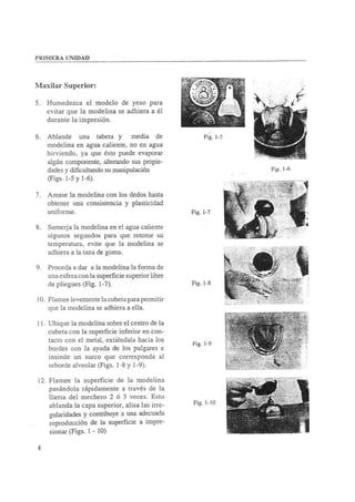 Manual de protesis total