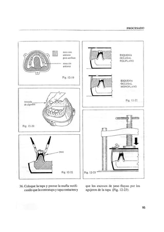 Manual de protesis total