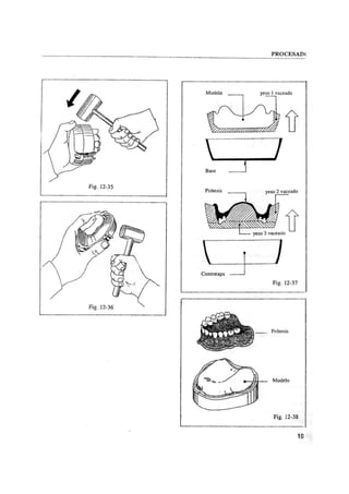 Manual de protesis total