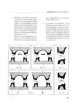 Manual de protesis total