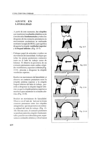 Manual de protesis total