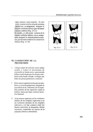 Manual de protesis total