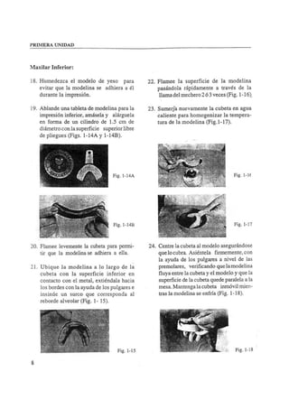Manual de protesis total