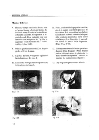 Manual de protesis total