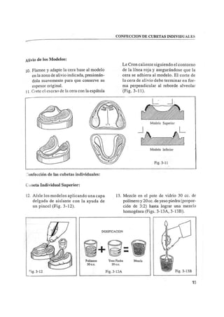 Manual de protesis total