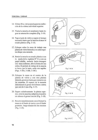 Manual de protesis total