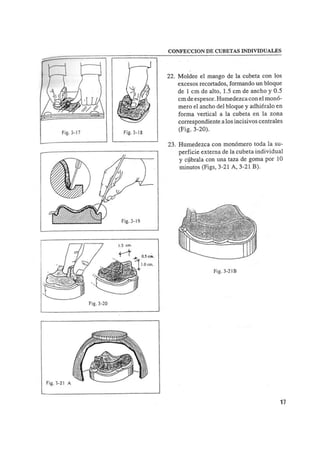 Manual de protesis total