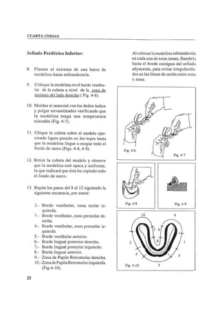 Manual de protesis total
