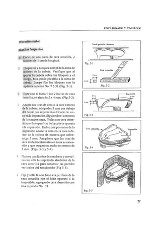 Manual de protesis total