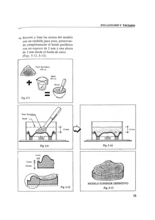 Manual de protesis total