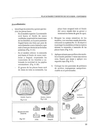 Manual de protesis total