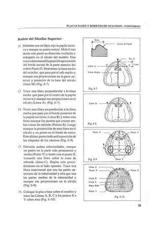 Manual de protesis total