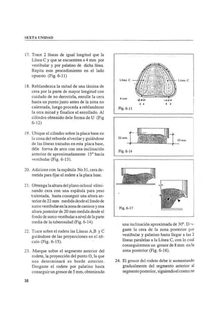 Manual de protesis total