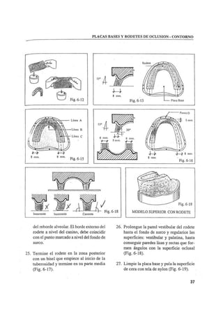 Manual de protesis total