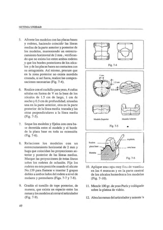 Manual de protesis total