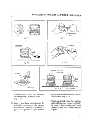 Manual de protesis total