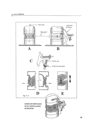 Manual de protesis total