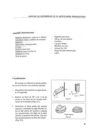 Manual de protesis total