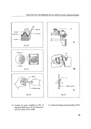 Manual de protesis total