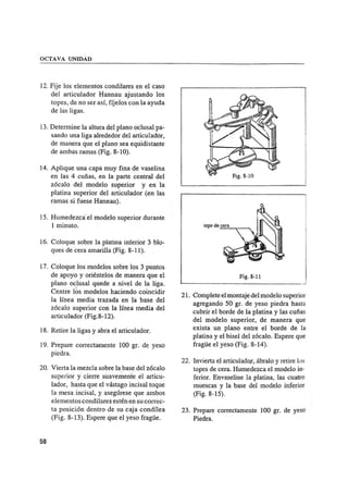 Manual de protesis total