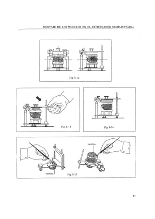 Manual de protesis total