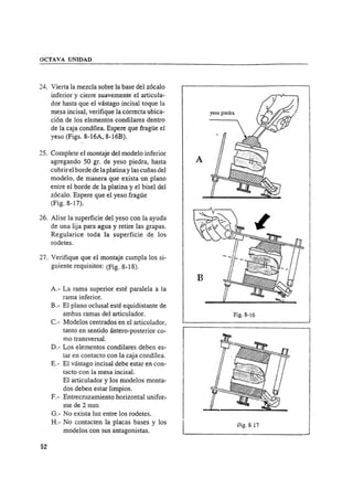Manual de protesis total