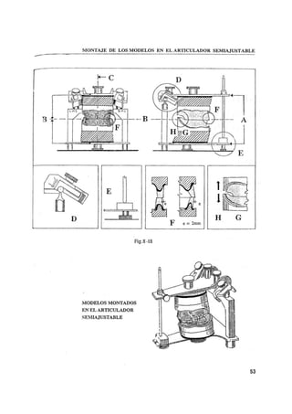Manual de protesis total