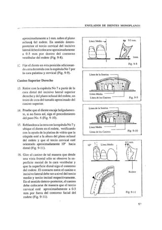 Manual de protesis total