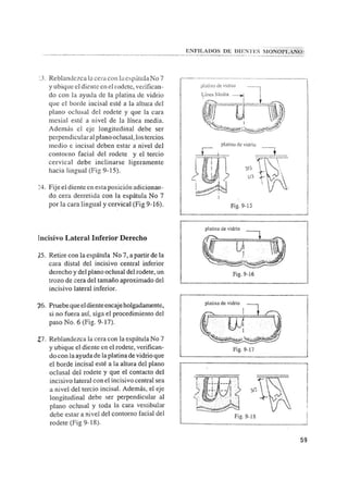 Manual de protesis total