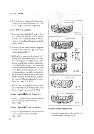 Manual de protesis total
