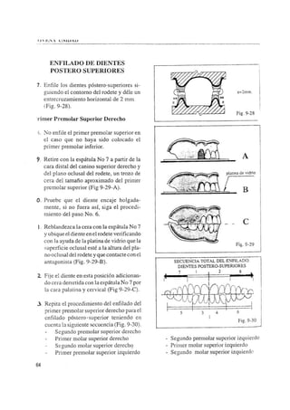 Manual de protesis total