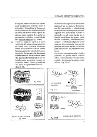 Manual de protesis total