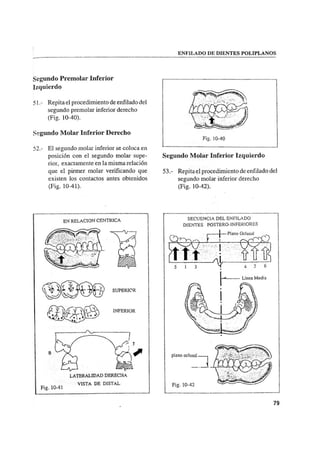Manual de protesis total