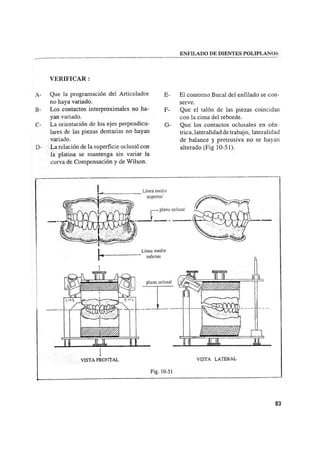 Manual de protesis total