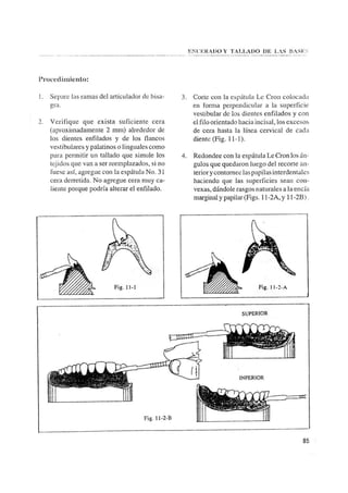 Manual de protesis total