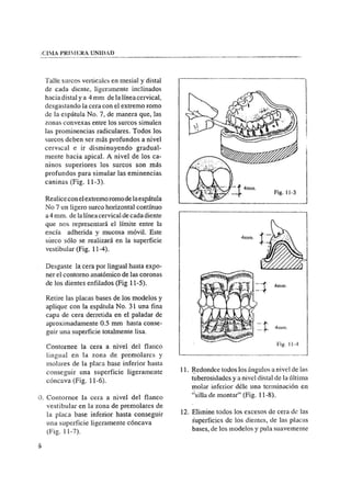 Manual de protesis total