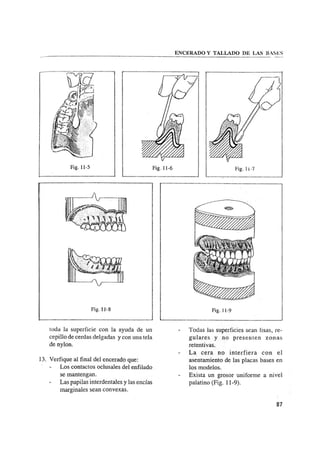 Manual de protesis total