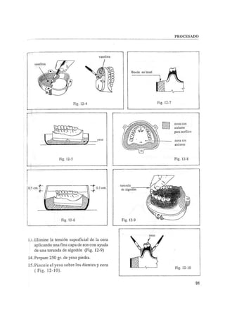 Manual de protesis total