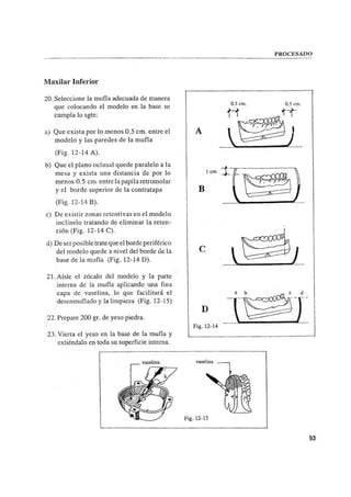 Manual de protesis total