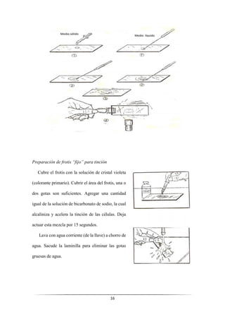 16
Preparación de frotis “fijo” para tinción
Cubre el frotis con la solución de cristal violeta
(colorante primario). Cubrir el área del frotis, una o
dos gotas son suficientes. Agregar una cantidad
igual de la solución de bicarbonato de sodio, la cual
alcaliniza y acelera la tinción de las células. Deja
actuar esta mezcla por 15 segundos.
Lava con agua corriente (de la llave) a chorro de
agua. Sacude la laminilla para eliminar las gotas
gruesas de agua.
 