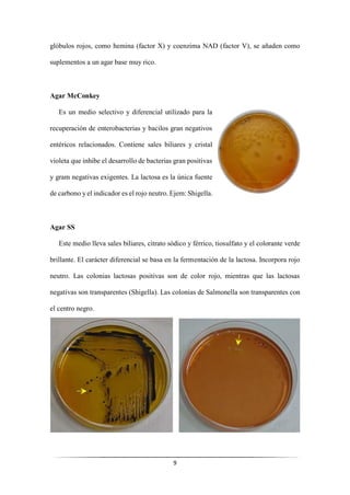 9
glóbulos rojos, como hemina (factor X) y coenzima NAD (factor V), se añaden como
suplementos a un agar base muy rico.
Agar McConkey
Es un medio selectivo y diferencial utilizado para la
recuperación de enterobacterias y bacilos gran negativos
entéricos relacionados. Contiene sales biliares y cristal
violeta que inhibe el desarrollo de bacterias gran positivas
y gram negativas exigentes. La lactosa es la única fuente
de carbono y el indicador es el rojo neutro. Ejem: Shigella.
Agar SS
Este medio lleva sales biliares, citrato sódico y férrico, tiosulfato y el colorante verde
brillante. El carácter diferencial se basa en la fermentación de la lactosa. Incorpora rojo
neutro. Las colonias lactosas positivas son de color rojo, mientras que las lactosas
negativas son transparentes (Shigella). Las colonias de Salmonella son transparentes con
el centro negro.
 