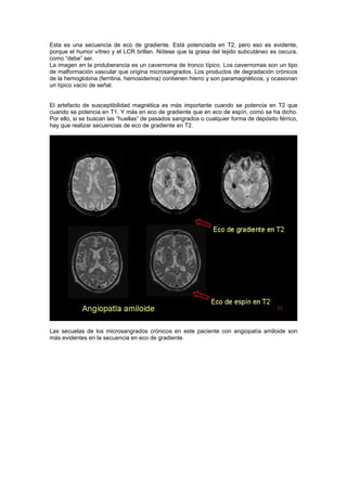 Manual de Semiología básica RMN | PDF